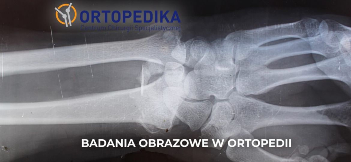 Ortopedika-1200x675